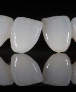 Răng sứ Bio