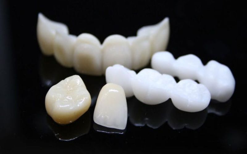 Răng sứ EMAX