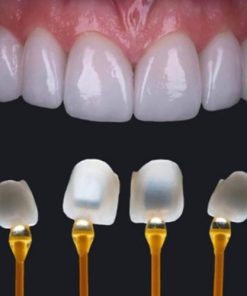 Răng sứ EMAX