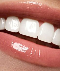 Răng Sứ Zirconia