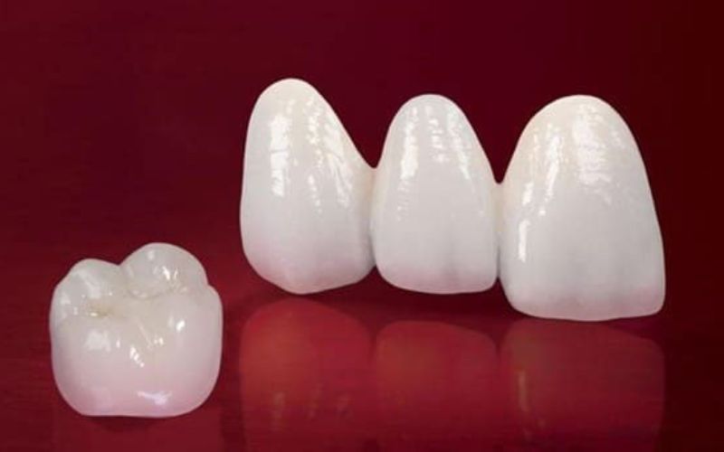 răng sứ cercon