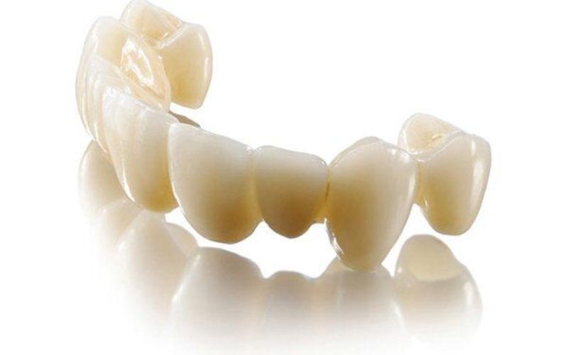 răng sứ lava 3m