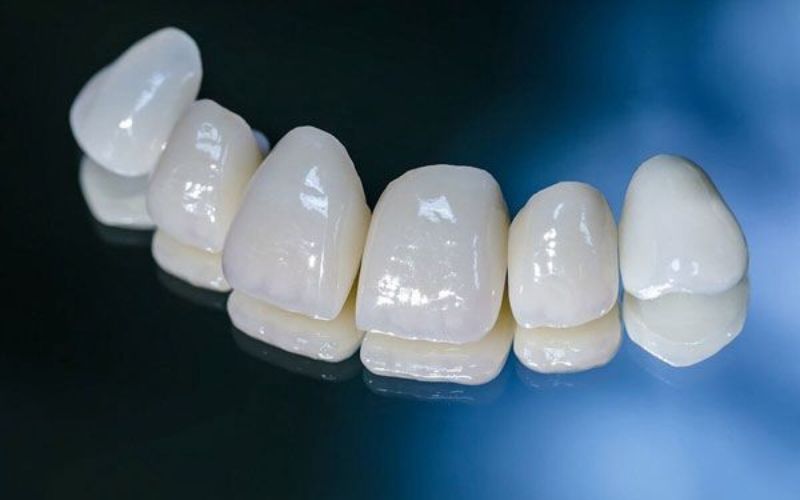răng sứ lava 3m