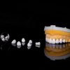 răng sứ orodent