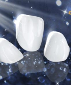 răng sứ orodent
