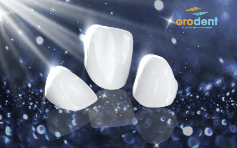 răng sứ orodent