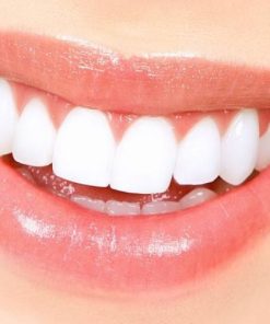 răng sứ roland